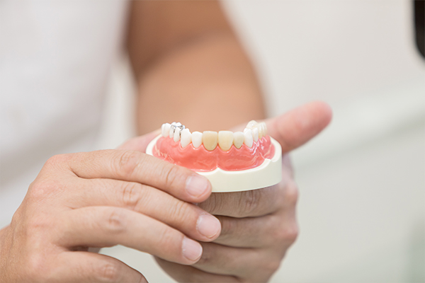 症状が現れてからお越しになった場合、すでに虫歯・歯周病が進行していたということがよくあります。